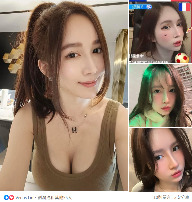 縮人中合併人中窩手術